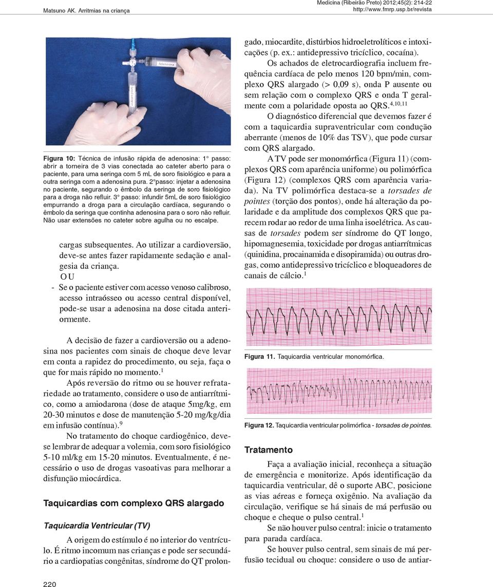 e para a outra seringa com a adenosina pura. 2 passo: injetar a adenosina no paciente, segurando o êmbolo da seringa de soro fisiológico para a droga não refluir.