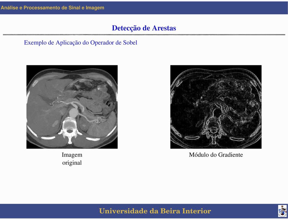 Detecção de Arestas