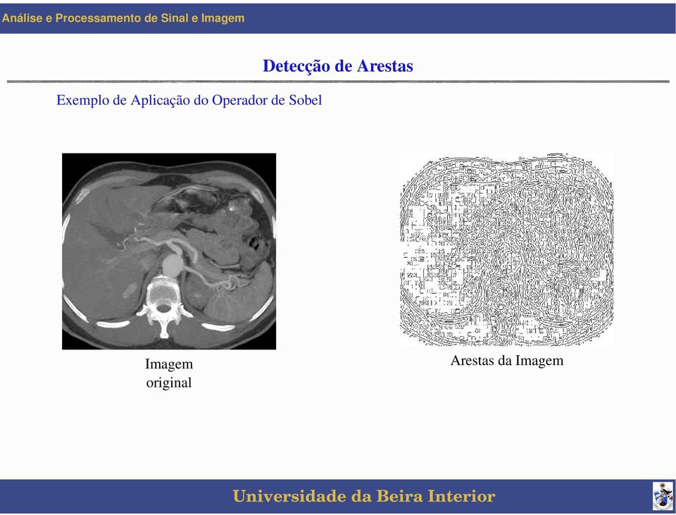 Detecção de Arestas