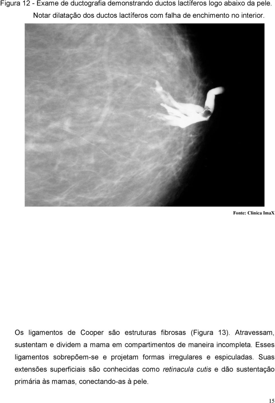 Fonte: Clinica ImaX Os ligamentos de Cooper são estruturas fibrosas (Figura 13).