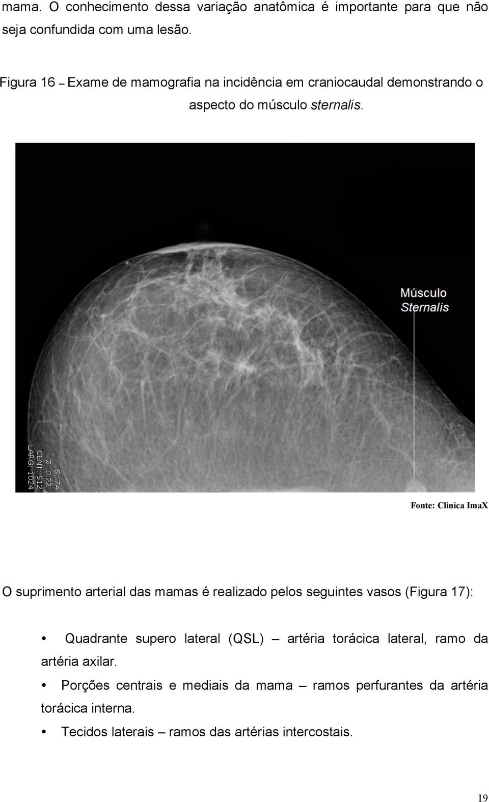Fonte: Clinica ImaX O suprimento arterial das mamas é realizado pelos seguintes vasos (Figura 17): Quadrante supero lateral (QSL)