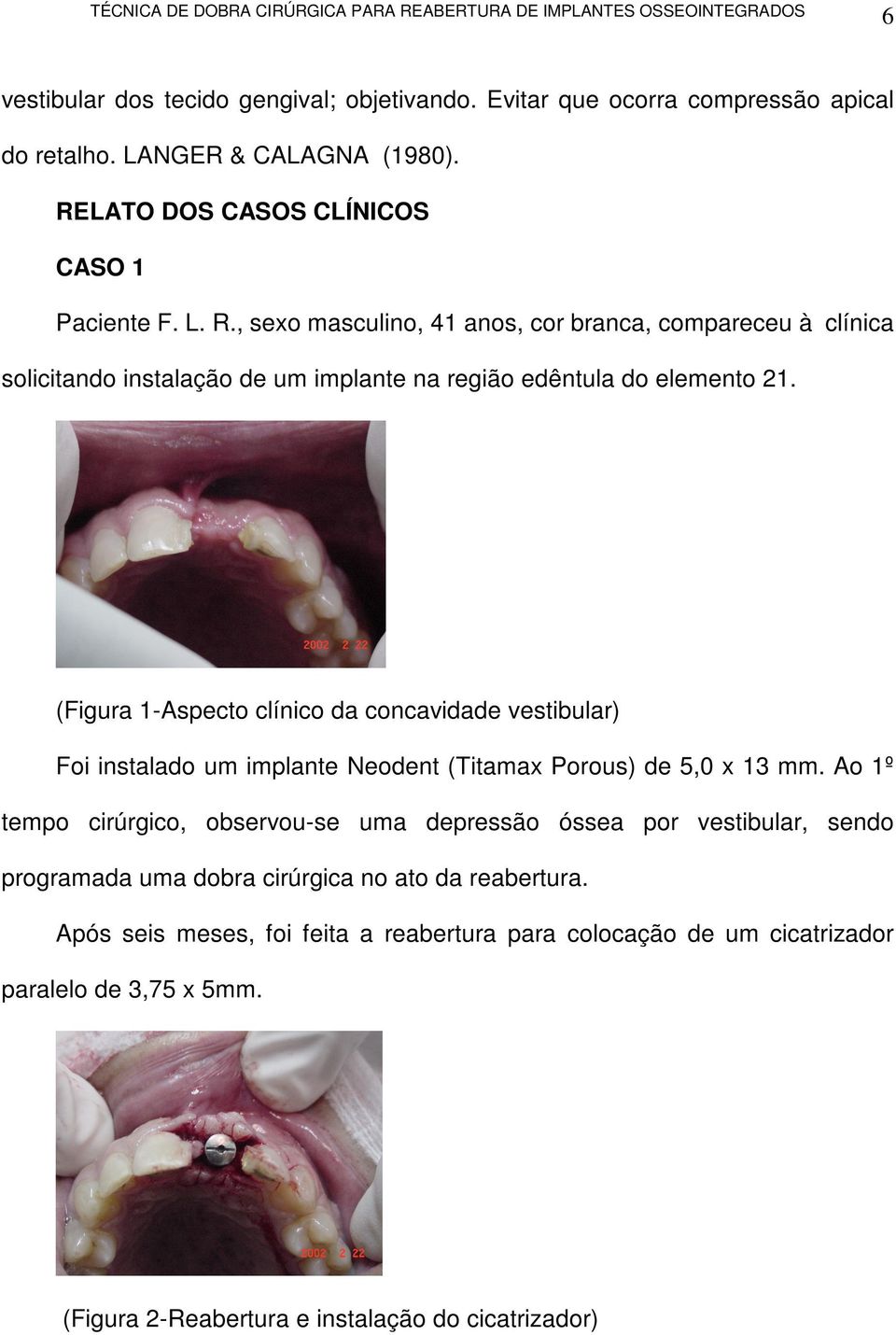 , sexo masculino, 41 anos, cor branca, compareceu à clínica solicitando instalação de um implante na região edêntula do elemento 21.