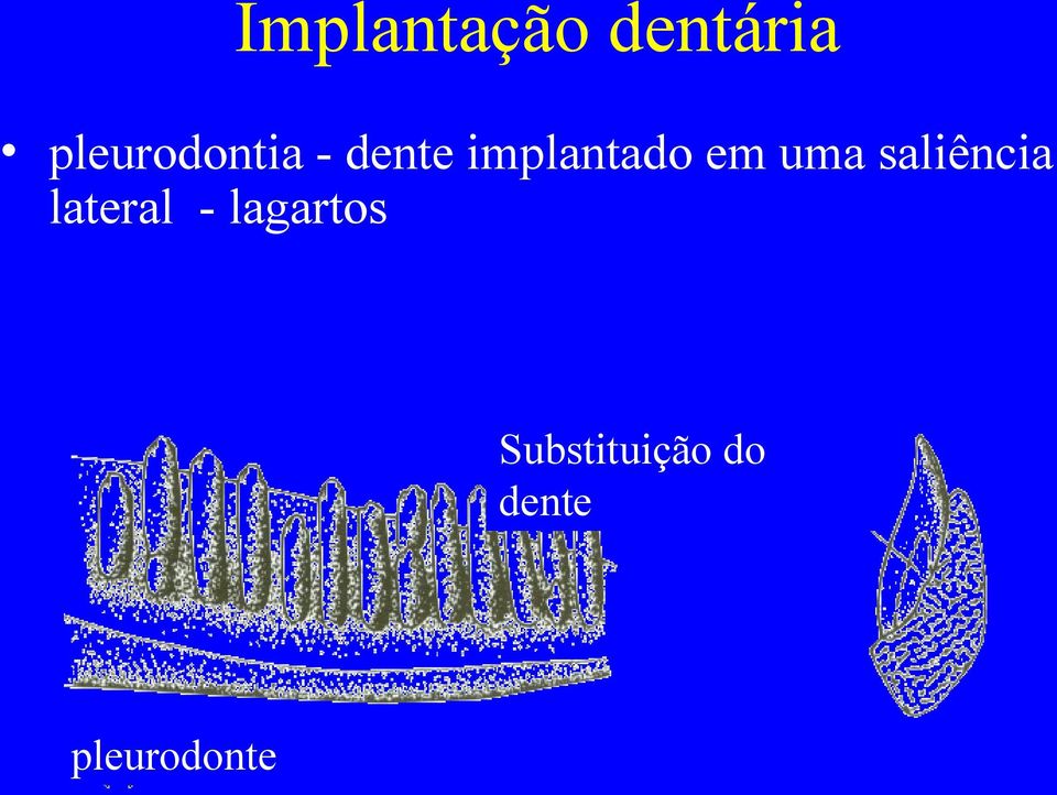 implantado em uma saliência