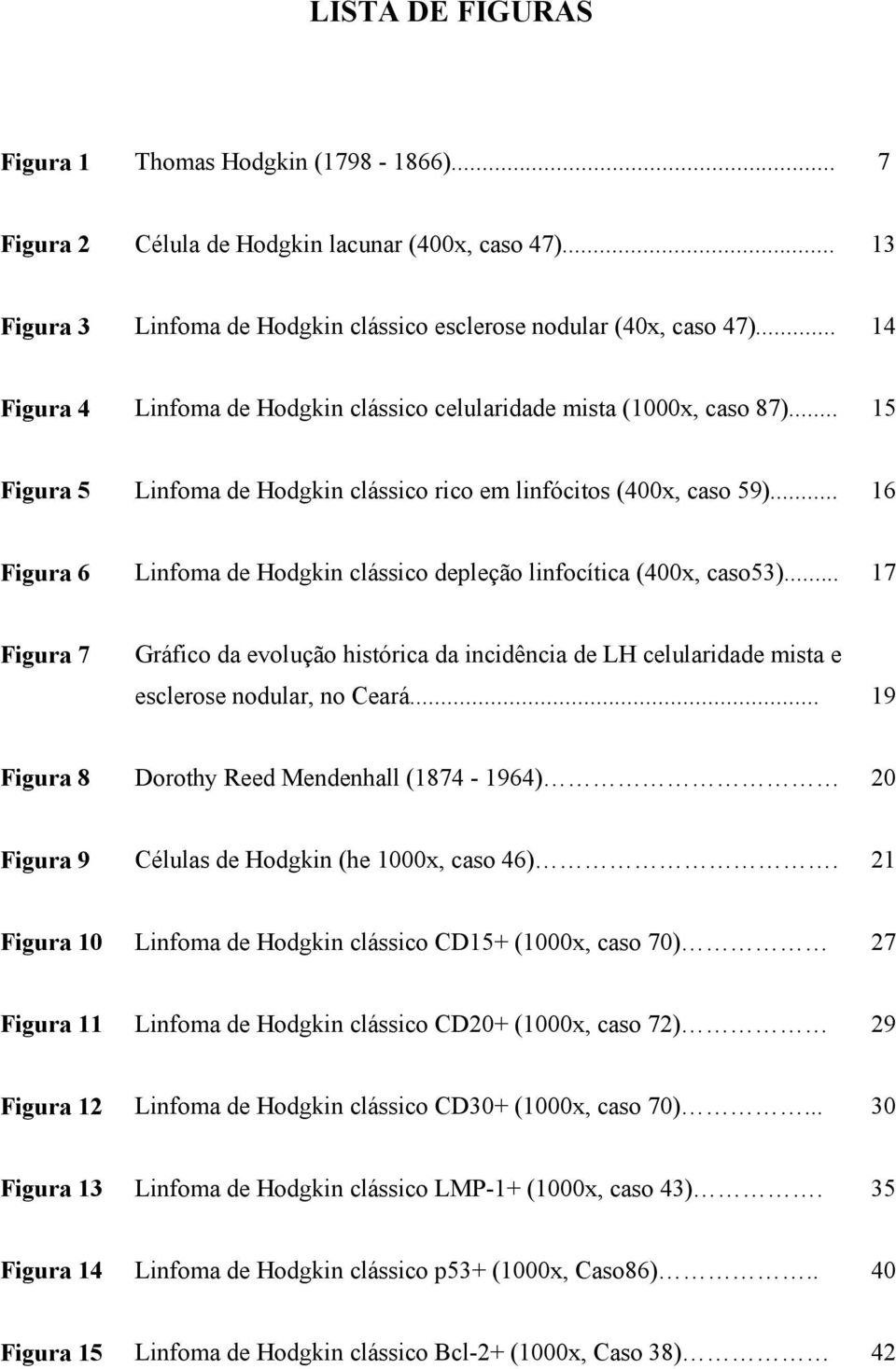 .. 16 Figura 6 Linfoma de Hodgkin clássico depleção linfocítica (400x, caso53)... 17 Figura 7 Gráfico da evolução histórica da incidência de LH celularidade mista e esclerose nodular, no Ceará.