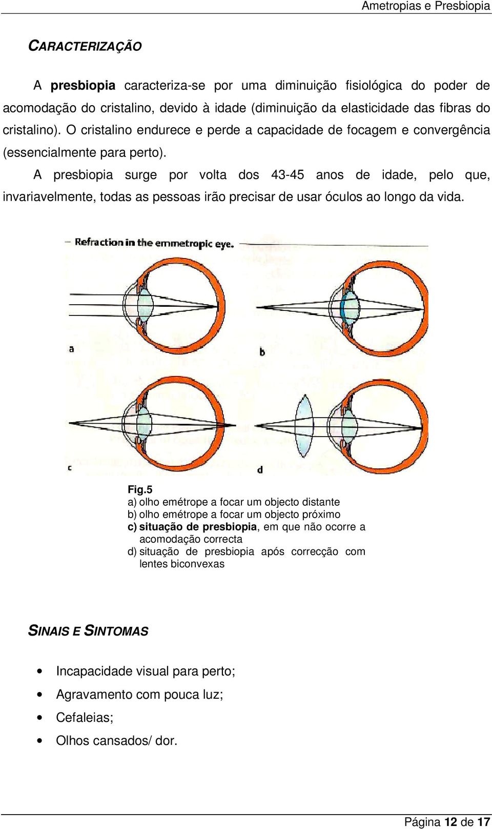 A presbiopia surge por volta dos 43-45 anos de idade, pelo que, invariavelmente, todas as pessoas irão precisar de usar óculos ao longo da vida. Fig.