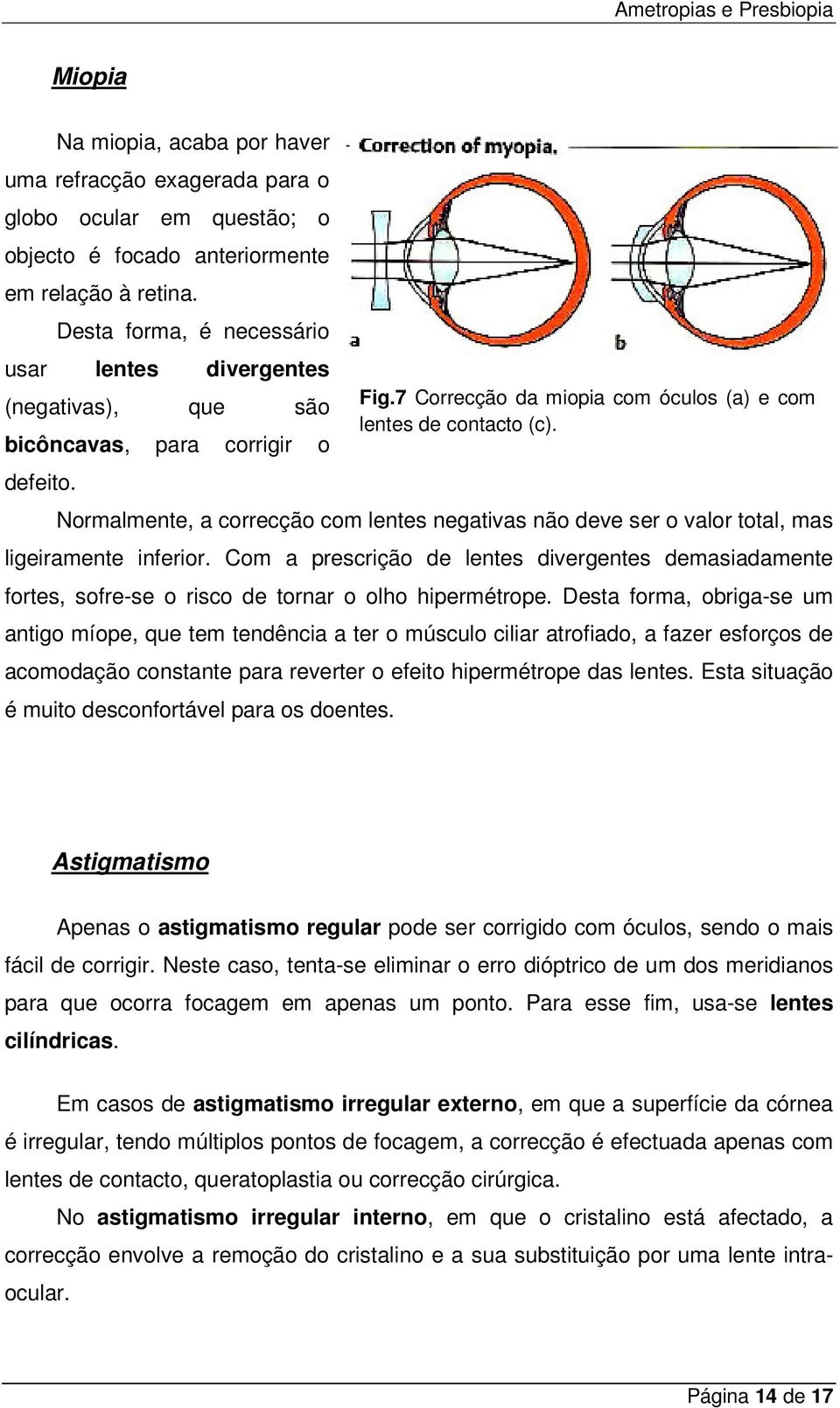 Normalmente, a correcção com lentes negativas não deve ser o valor total, mas ligeiramente inferior.