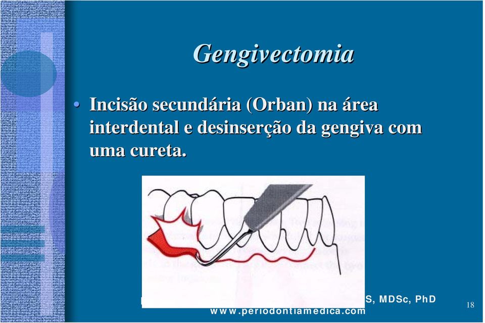 área interdental e