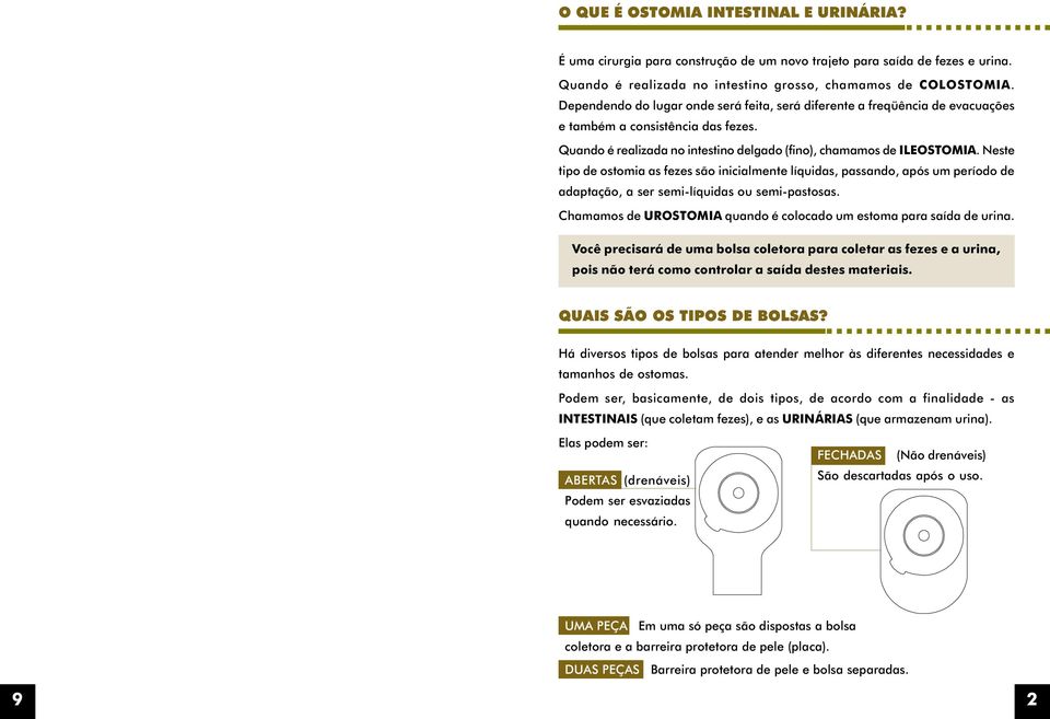 Neste tipo de ostomia as fezes são inicialmente líquidas, passando, após um período de adaptação, a ser semi-líquidas ou semi-pastosas.