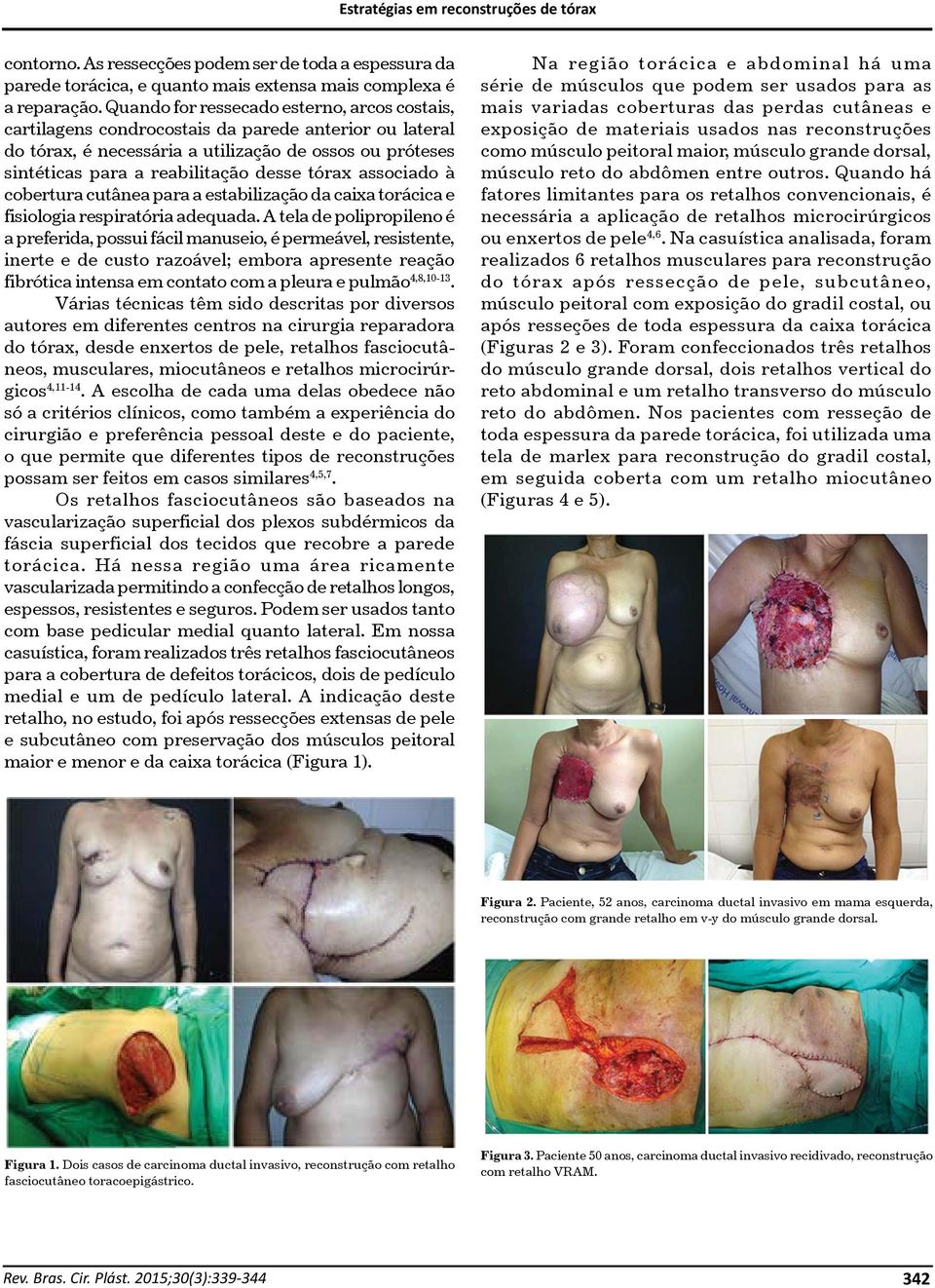 tórax associado à cobertura cutânea para a estabilização da caixa torácica e fisiologia respiratória adequada.