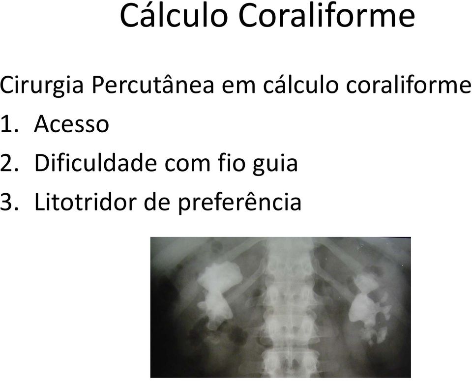 coraliforme 1. Acesso 2.