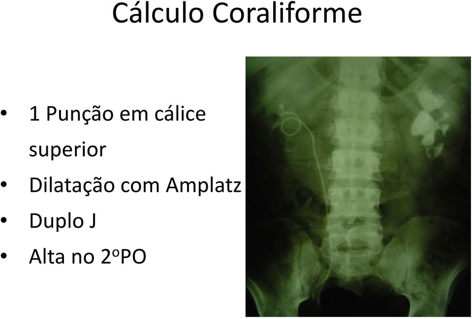 superior Dilatação com