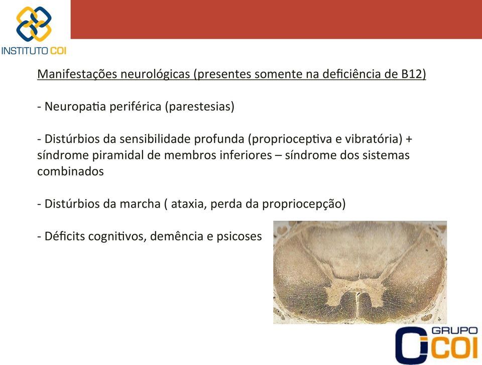 vibratória) + síndrome piramidal de membros inferiores síndrome dos sistemas