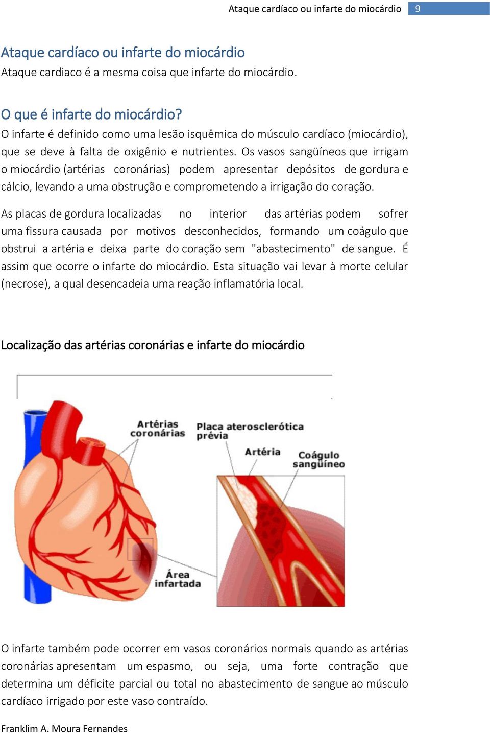 Os vasos sangüíneos que irrigam o miocárdio (artérias coronárias) podem apresentar depósitos de gordura e cálcio, levando a uma obstrução e comprometendo a irrigação do coração.