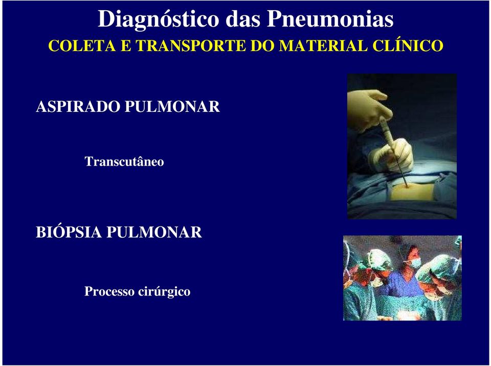 PULMONAR Transcutâneo