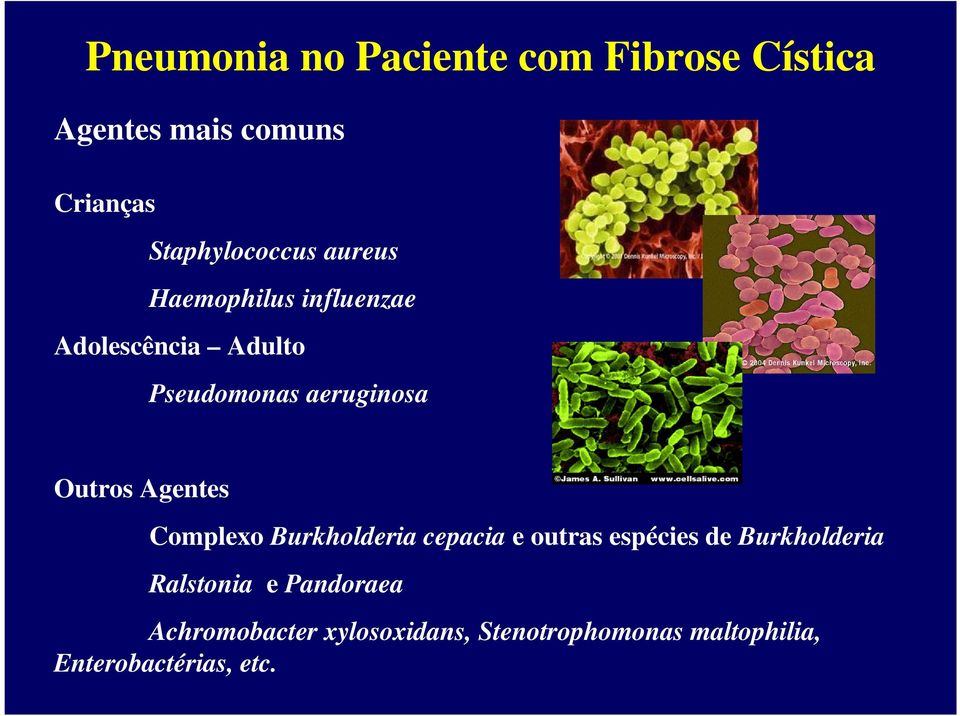 aeruginosa Outros Agentes Complexo Burkholderia cepacia e outras espécies de