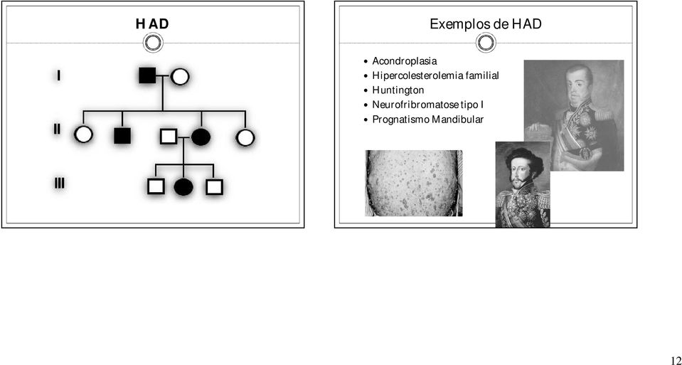 Hipercolesterolemia familial