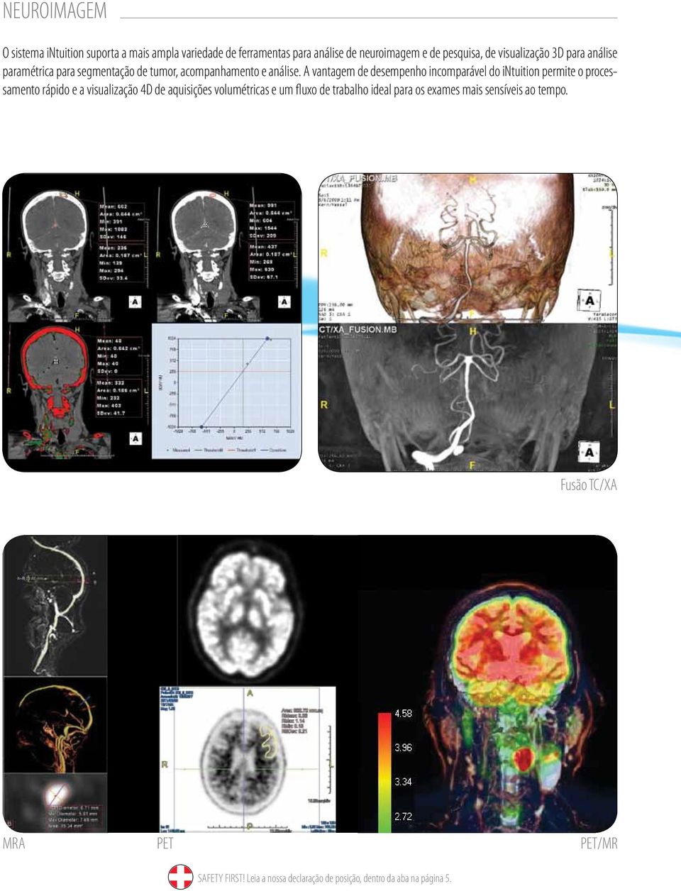 A vantagem de desempenho incomparável do intuition permite o processamento rápido e a visualização 4D de