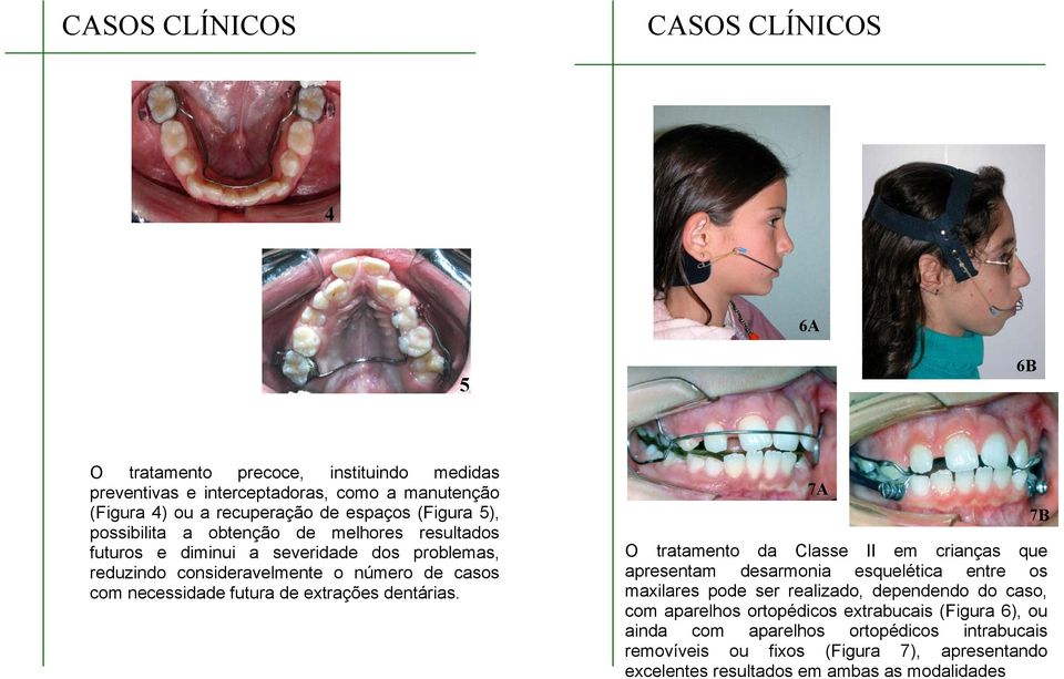 de extrações dentárias.