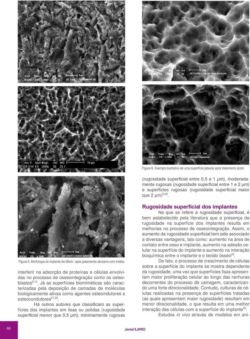 (rugosidade superficial maior que 2 µm) 9,29. Figura 5. Morfologia do implante de titânio após jateamento abrasivo com óxidos.