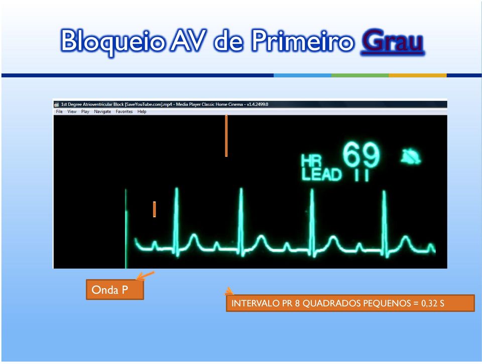 P INTERVALO PR 8