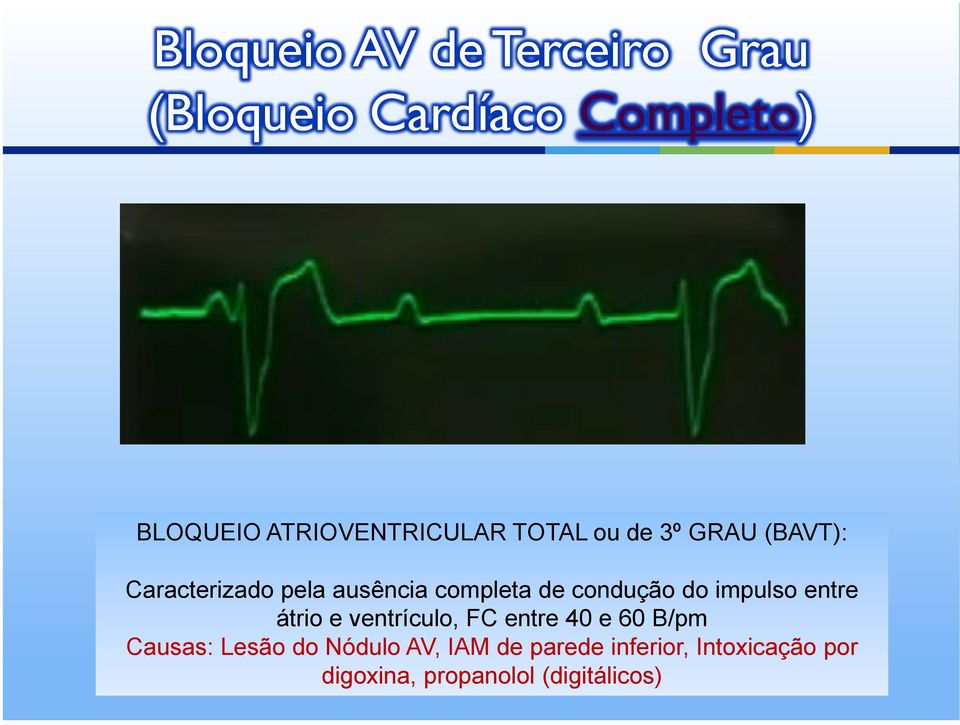 completa de condução do impulso entre átrio e ventrículo, FC entre 40 e 60 B/pm