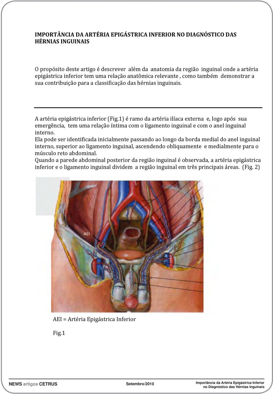 1) é ramo da artéria ilíaca externa e, logo após sua emergência, tem uma relação íntima com o ligamento inguinal e com o anel inguinal interno.