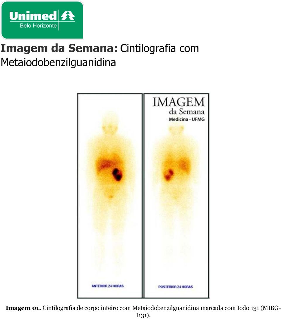 Cintilografia de corpo inteiro com