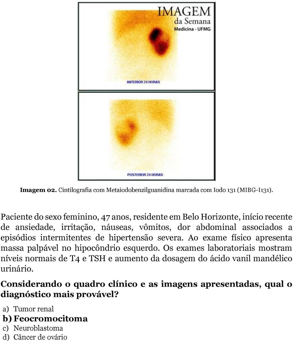 episódios intermitentes de hipertensão severa. Ao exame físico apresenta massa palpável no hipocôndrio esquerdo.