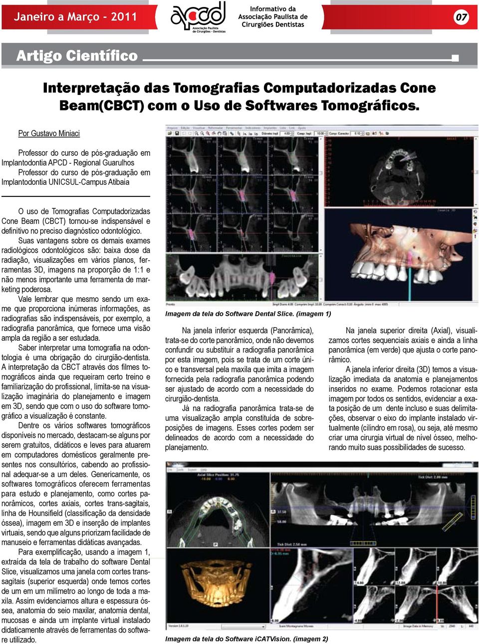 Computadorizadas Cone Beam (CBCT) tornou-se indispensável e definitivo no preciso diagnóstico odontológico.