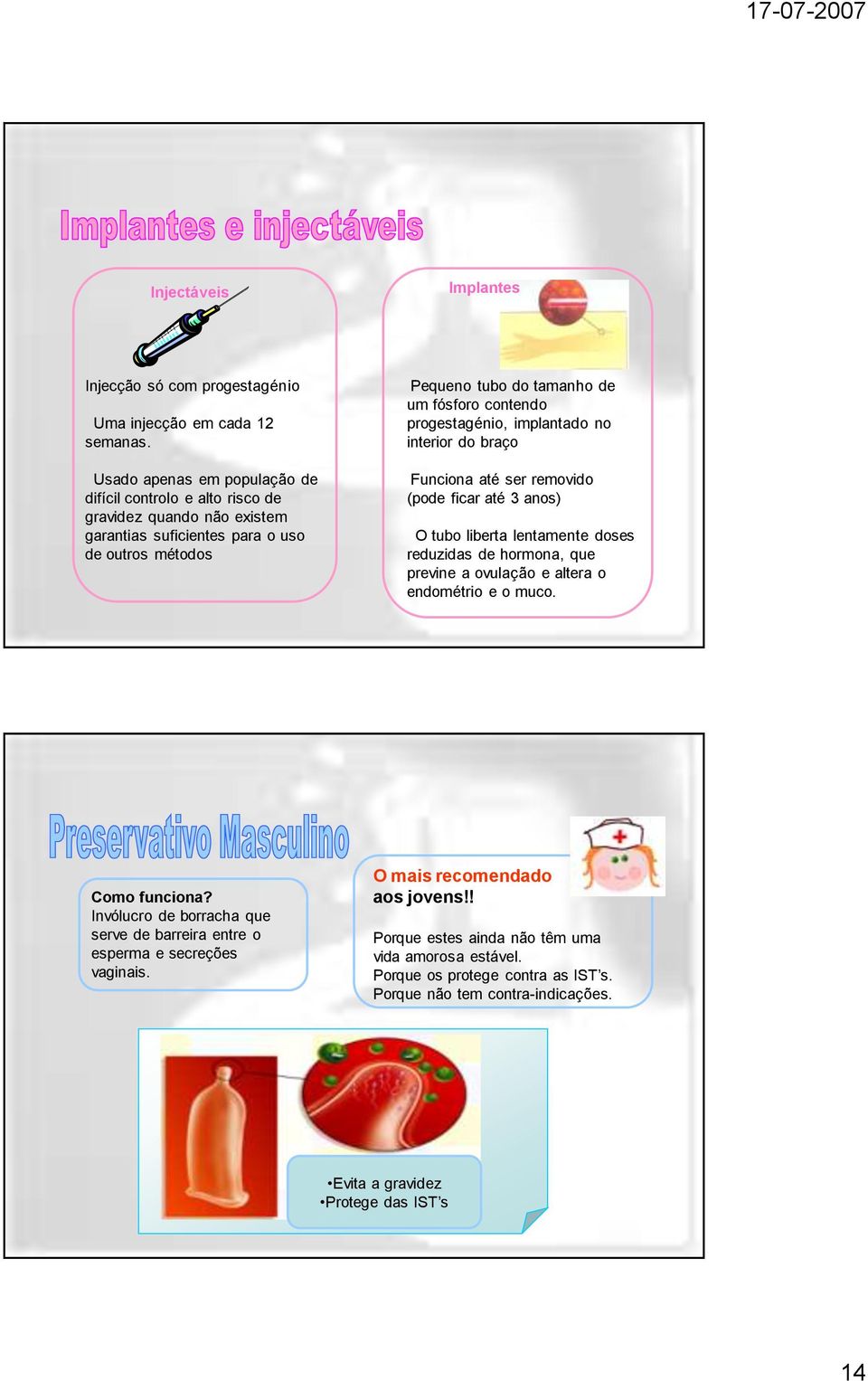 progestagénio, implantado no interior do braço Funciona até ser removido (pode ficar até 3 anos) O tubo liberta lentamente doses reduzidas de hormona, que previne a ovulação e altera o