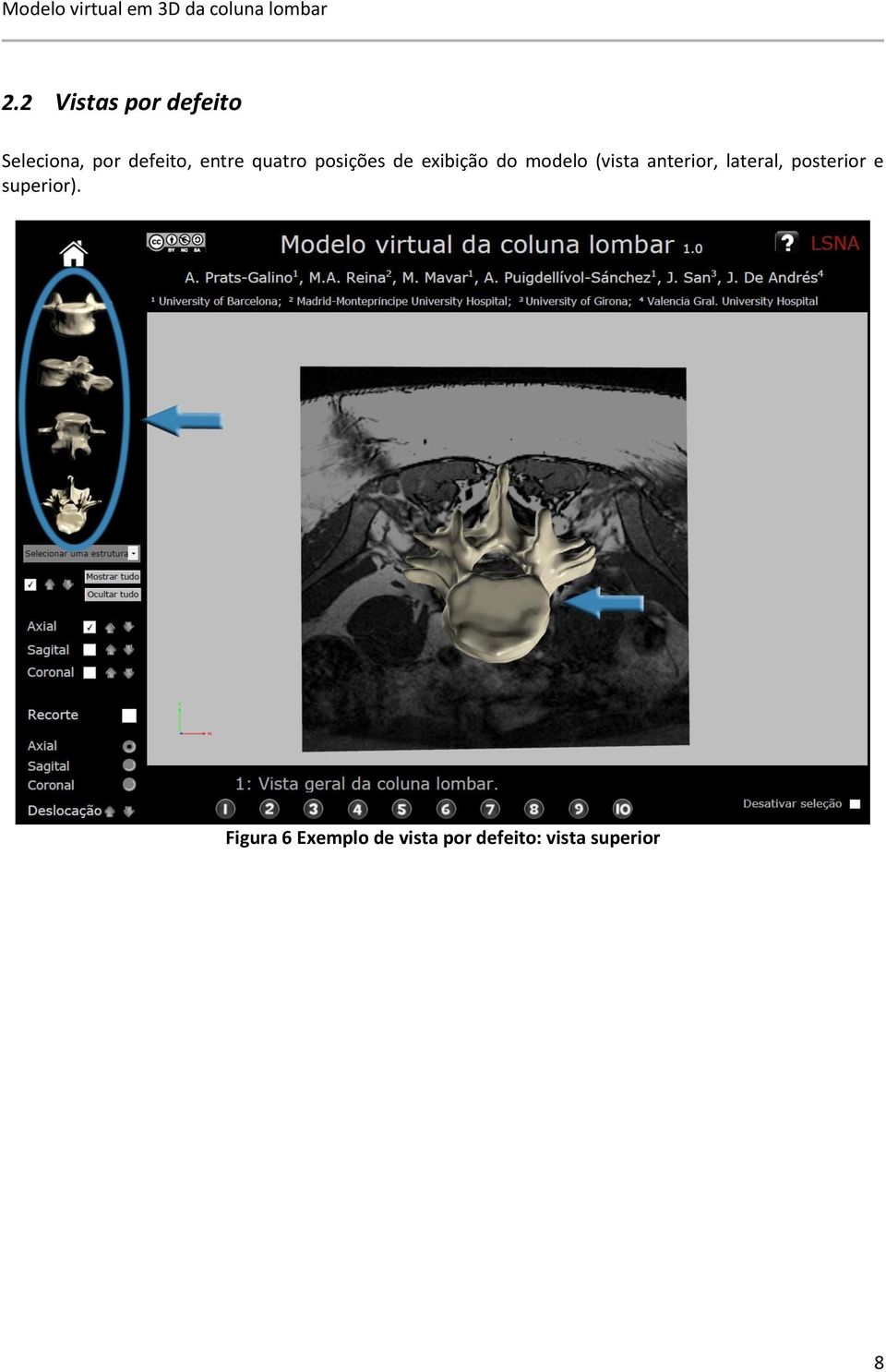 (vista anterior, lateral, posterior e superior).