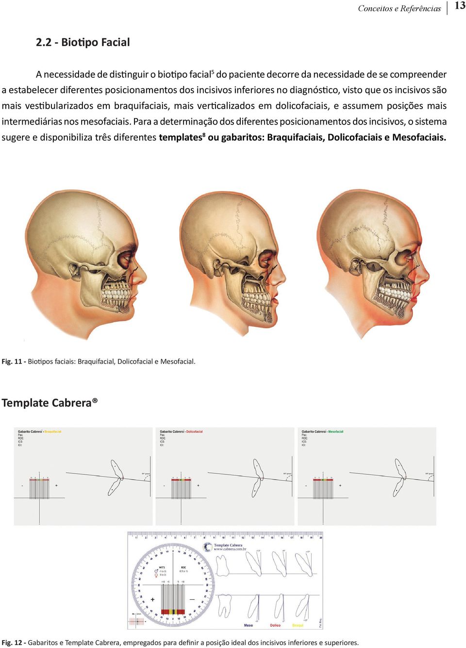 diagnóstico, visto que os incisivos são mais vestibularizados em braquifaciais, mais verticalizados em dolicofaciais, e assumem posições mais intermediárias nos mesofaciais.