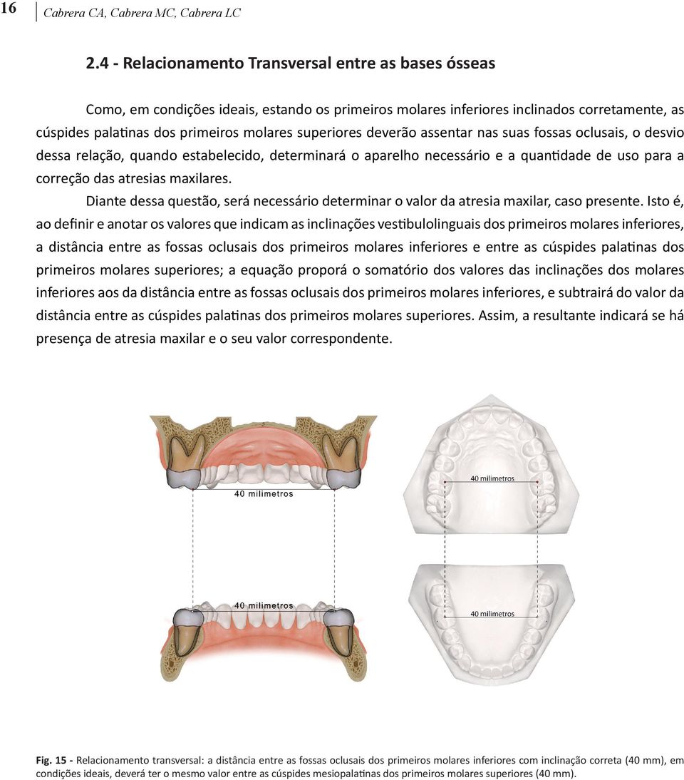 deverão assentar nas suas fossas oclusais, o desvio dessa relação, quando estabelecido, determinará o aparelho necessário e a quantidade de uso para a correção das atresias maxilares.