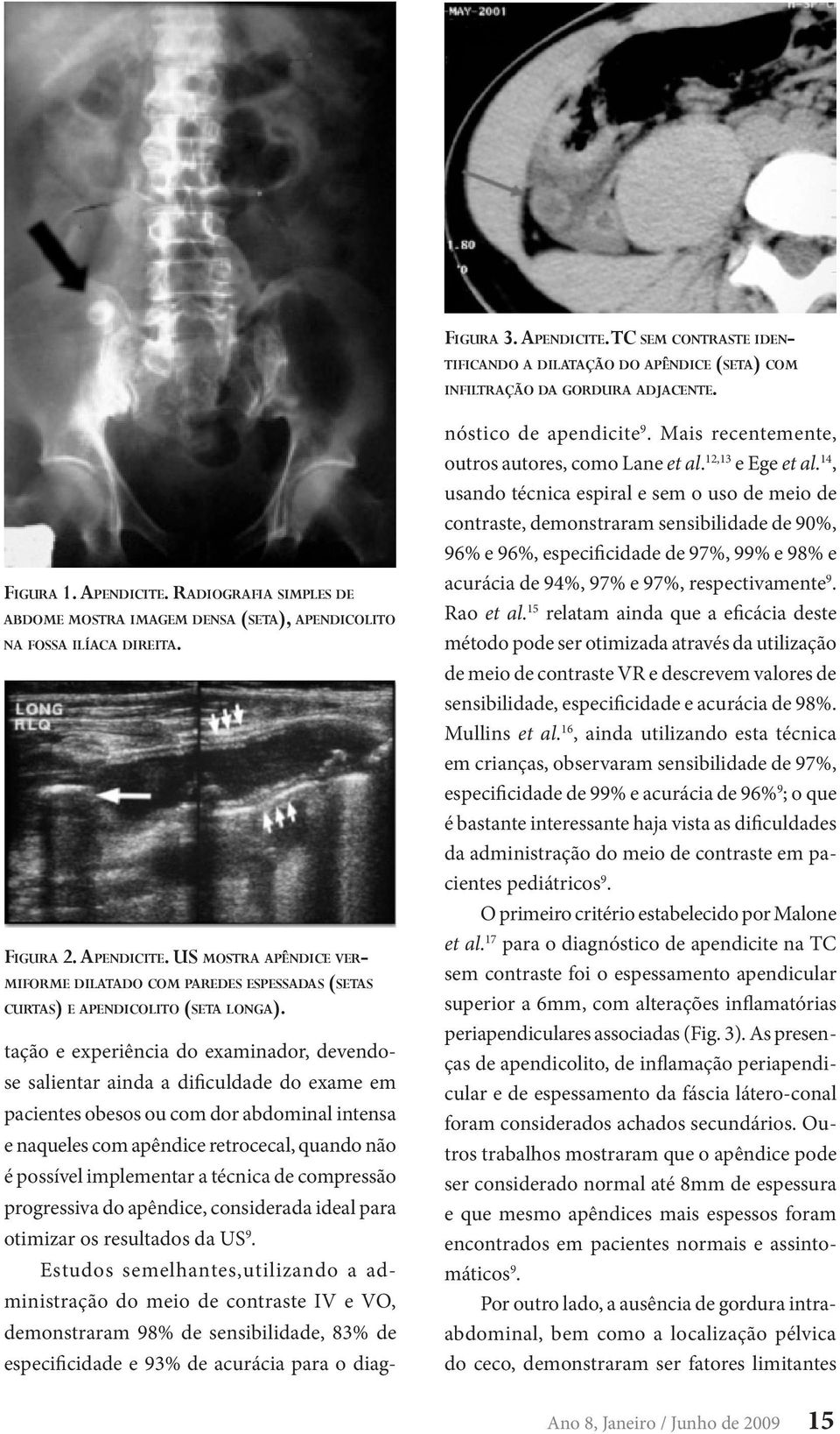 tação e experiência do examinador, devendose salientar ainda a dificuldade do exame em pacientes obesos ou com dor abdominal intensa e naqueles com apêndice retrocecal, quando não é possível