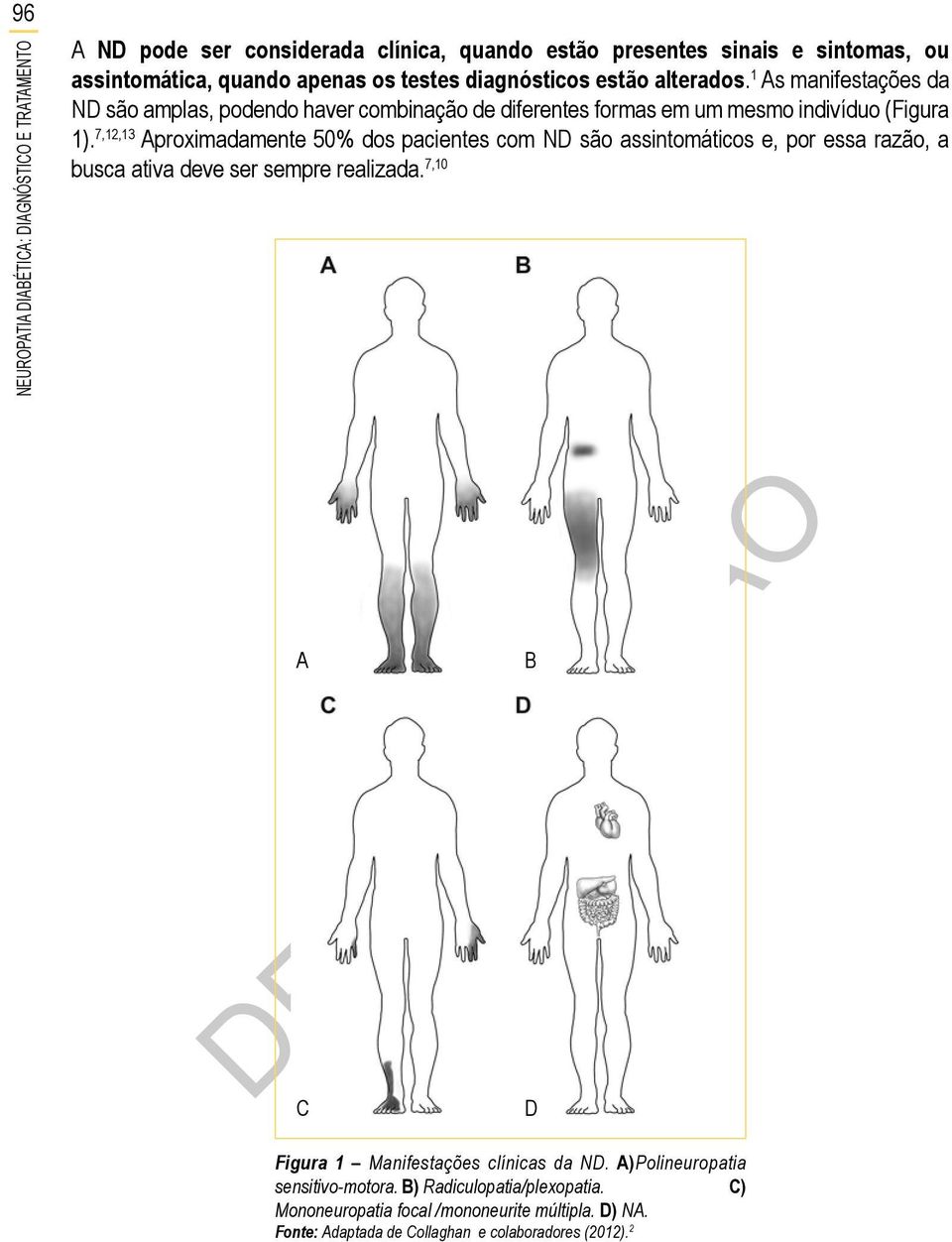 7,12,13 Aproximadamente 50% dos pacientes com ND são assintomáticos e, por essa razão, a busca ativa deve ser sempre realizada.