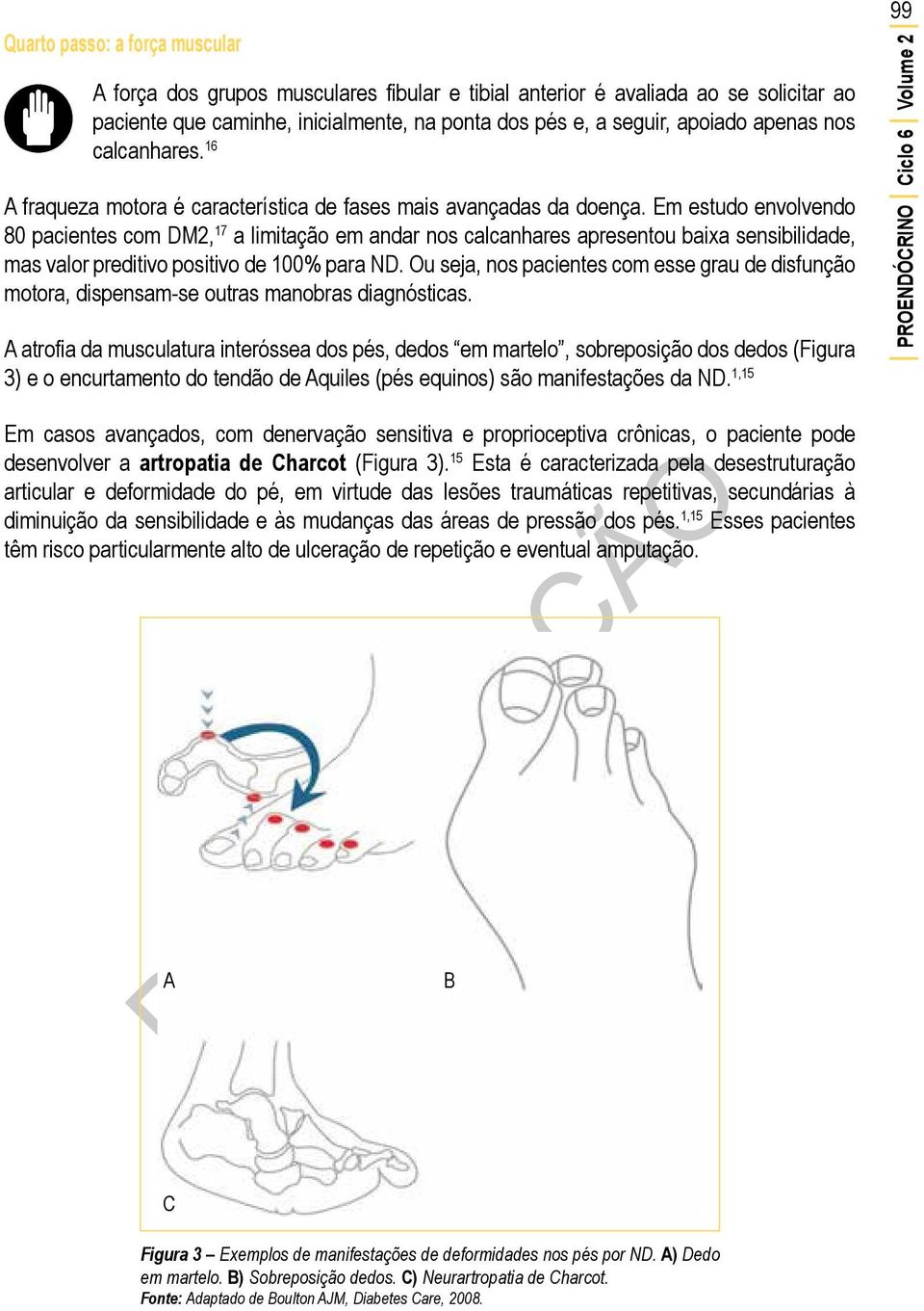 Em estudo envolvendo 80 pacientes com DM2, 17 a limitação em andar nos calcanhares apresentou baixa sensibilidade, mas valor preditivo positivo de 100% para ND.