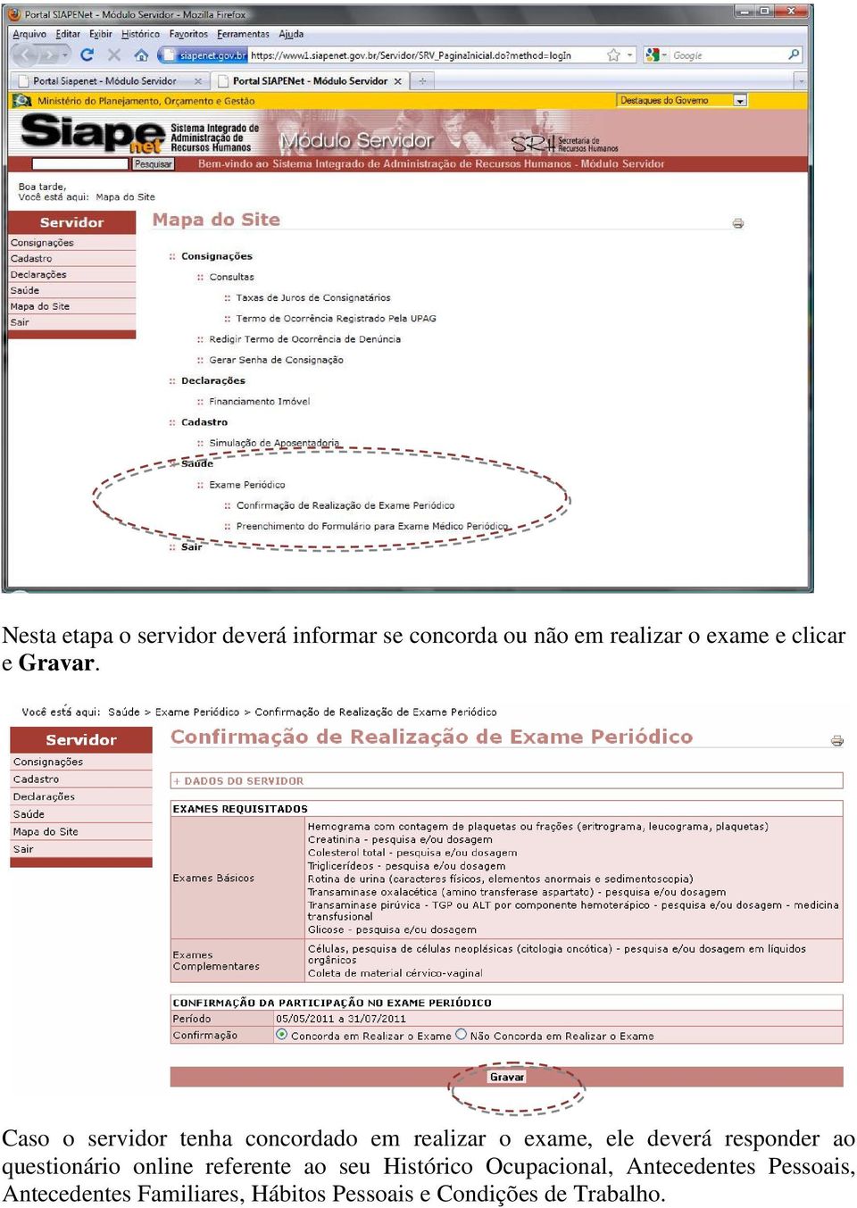 Caso o servidor tenha concordado em realizar o exame, ele deverá responder ao