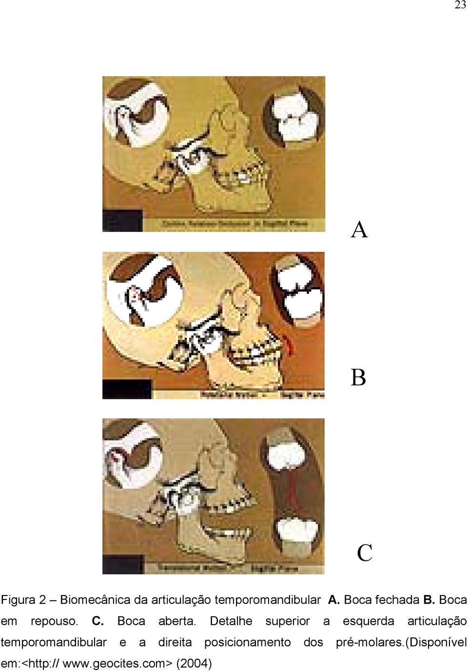 Detalhe superior a esquerda articulação temporomandibular e a