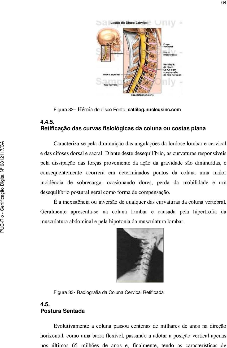 Diante deste desequilíbrio, as curvaturas responsáveis pela dissipação das forças proveniente da ação da gravidade são diminuídas, e conseqüentemente ocorrerá em determinados pontos da coluna uma