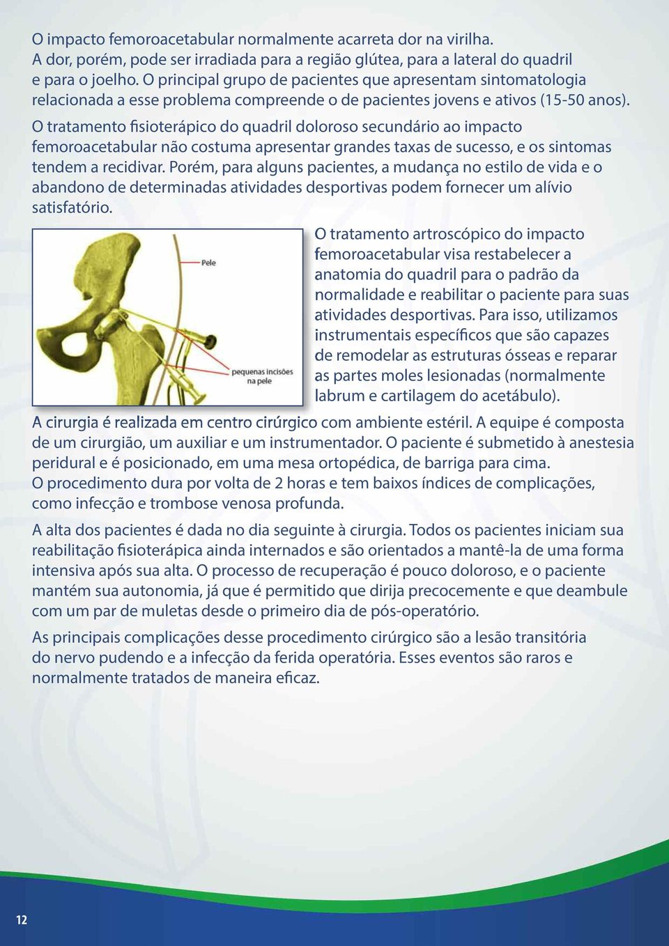 O tratamento fisioterápico do quadril doloroso secundário ao impacto femoroacetabular não costuma apresentar grandes taxas de sucesso, e os sintomas tendem a recidivar.