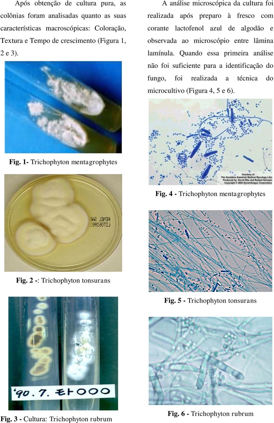 Quando essa primeira análise não foi suficiente para a identificação do fungo, foi realizada a técnica do microcultivo (Figura 4, 5 e 6). Fig.