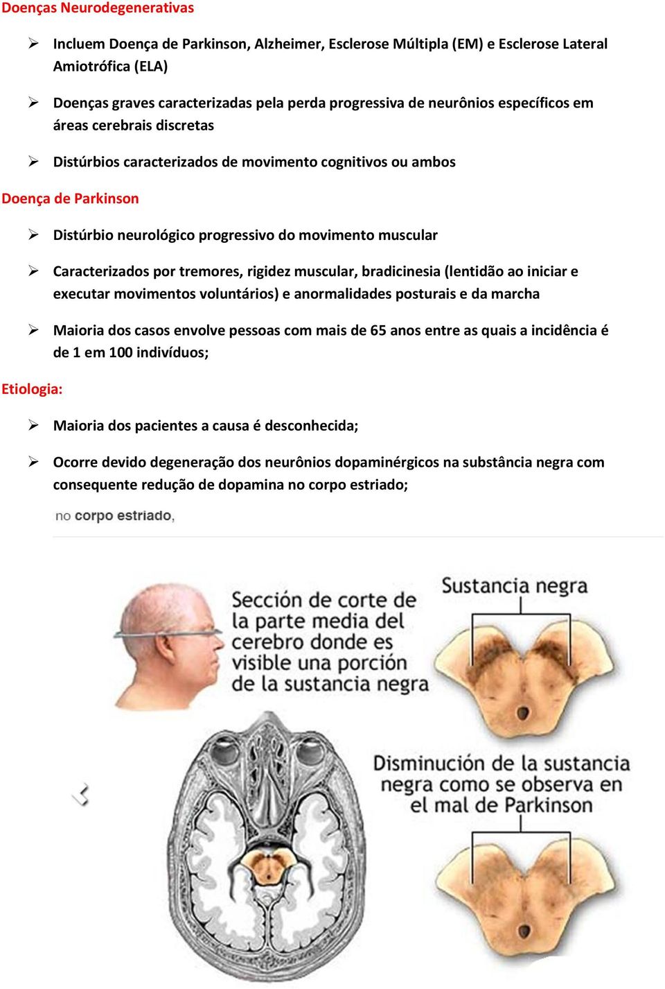 tremores, rigidez muscular, bradicinesia (lentidão ao iniciar e executar movimentos voluntários) e anormalidades posturais e da marcha Maioria dos casos envolve pessoas com mais de 65 anos entre as