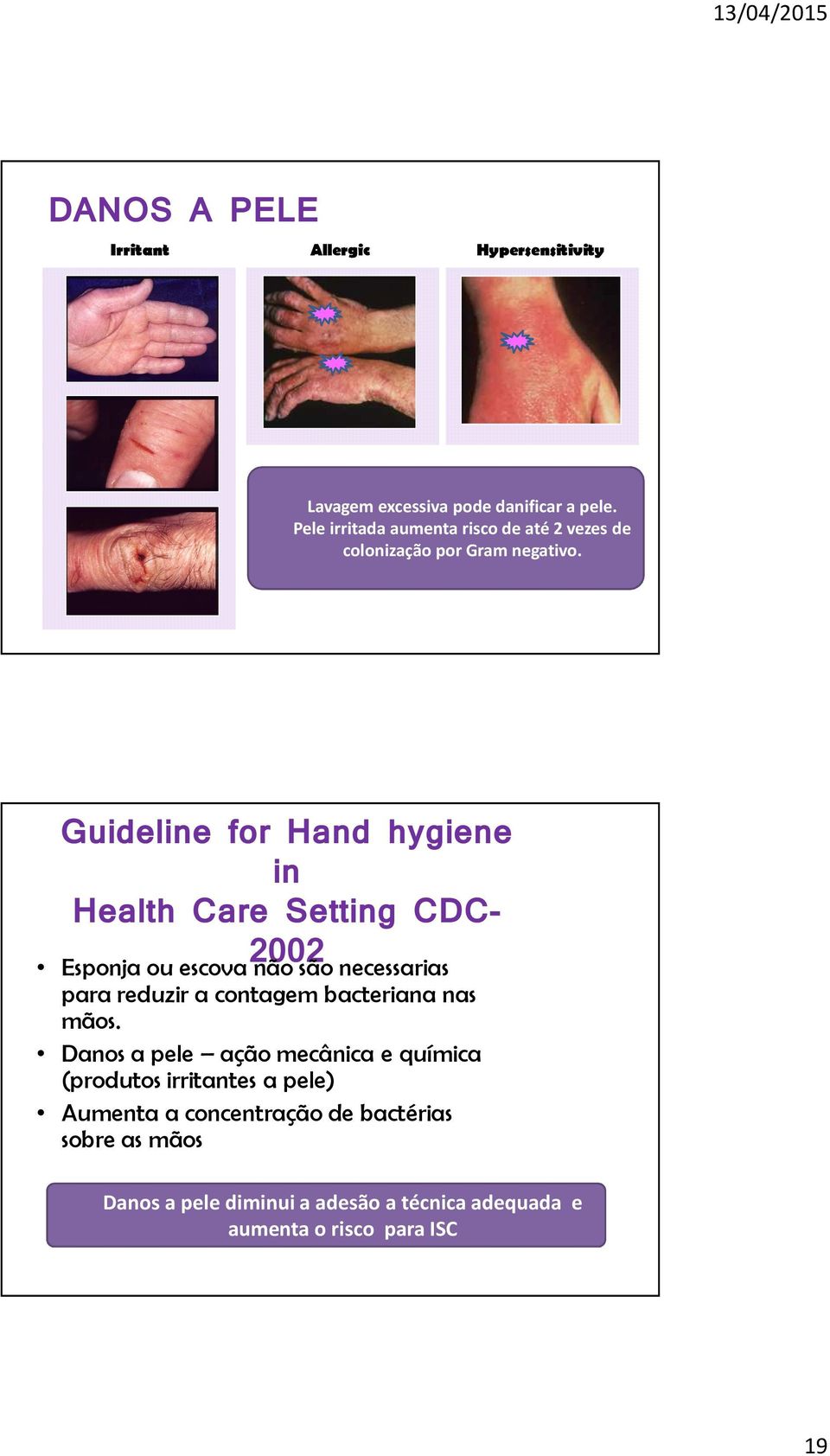 Guideline for Hand hygiene in Health Care Setting CDC- 2002 Esponja ou escova não são necessarias para reduzir a contagem