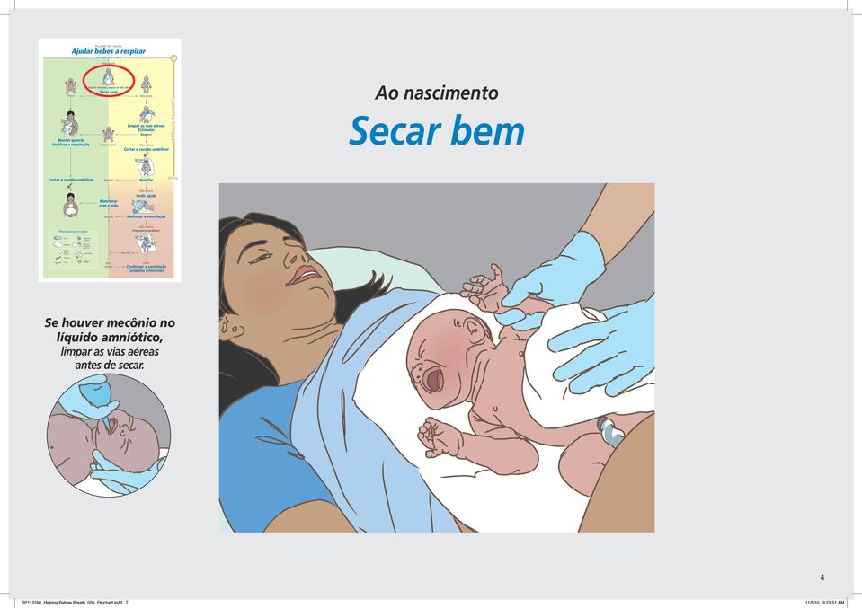 Ao nascimento Luvas 20-00371 rev B ventilação - máscara Se houver mecônio