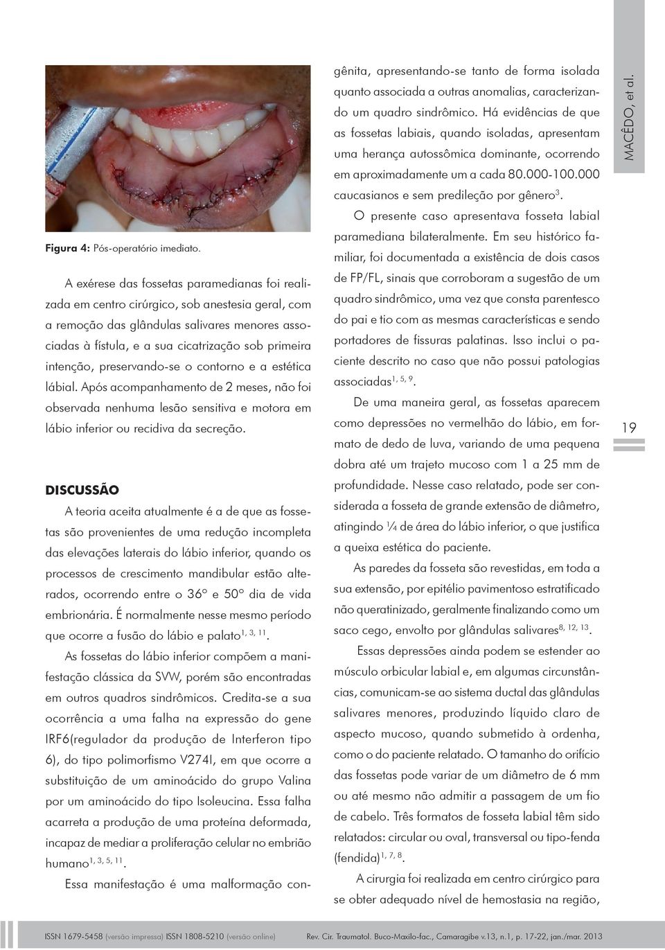 intenção, preservando-se o contorno e a estética lábial. Após acompanhamento de 2 meses, não foi observada nenhuma lesão sensitiva e motora em lábio inferior ou recidiva da secreção.