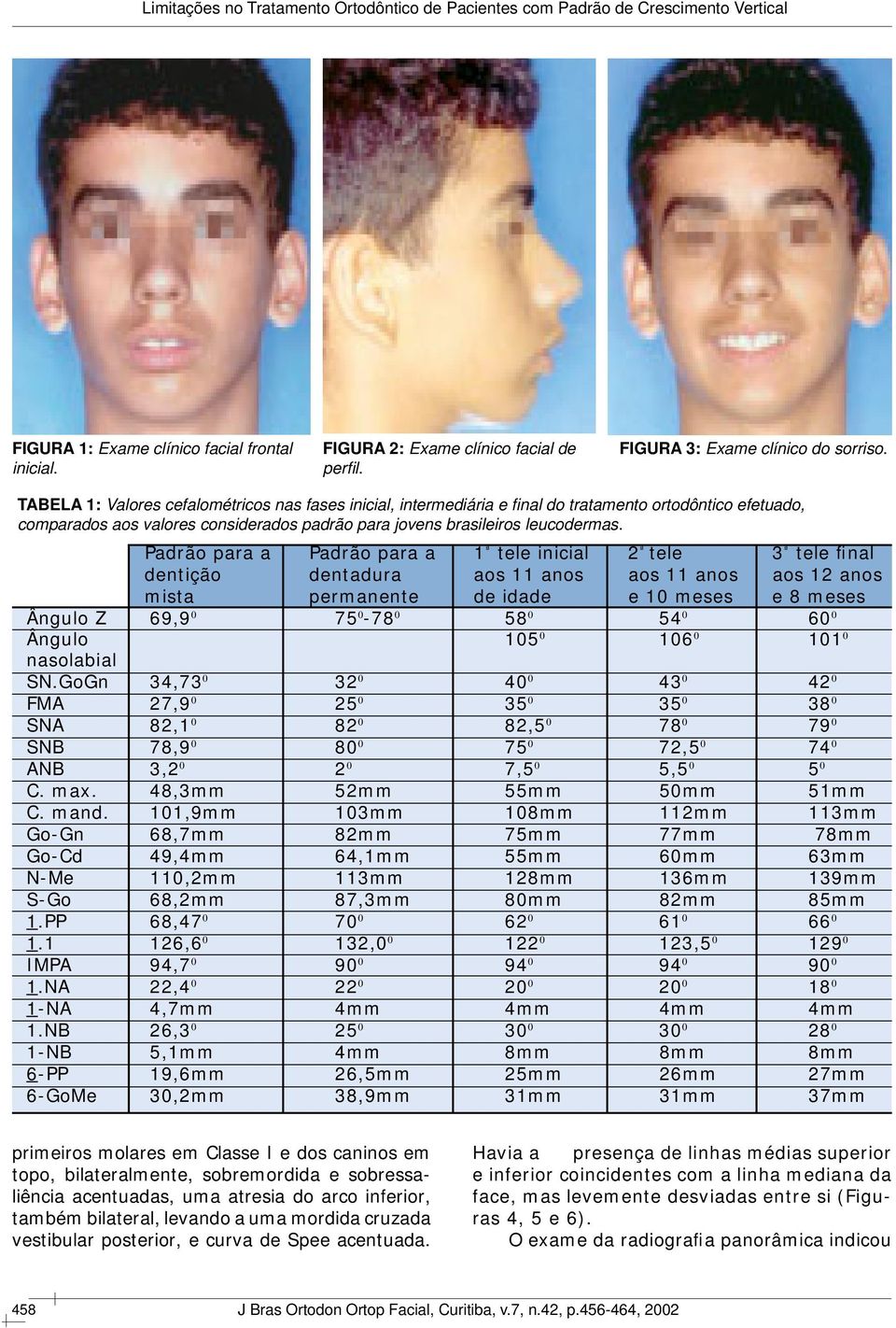 Padrão para a Padrão para a 1 ª tele inicial 2 ª tele 3 ª tele final dentição dentadura aos 11 anos aos 11 anos aos 12 anos mista permanente de idade e 10 meses e 8 meses Ângulo Z 69,9 0 75 0-78 0 58