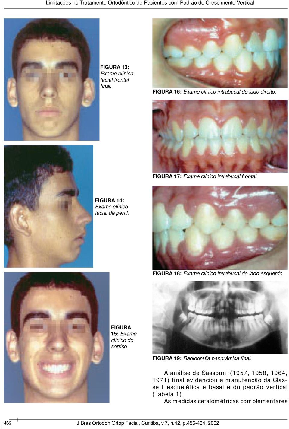 FIGURA 18: Exame clínico intrabucal do lado esquerdo. FIGURA 15: Exame clínico do sorriso.