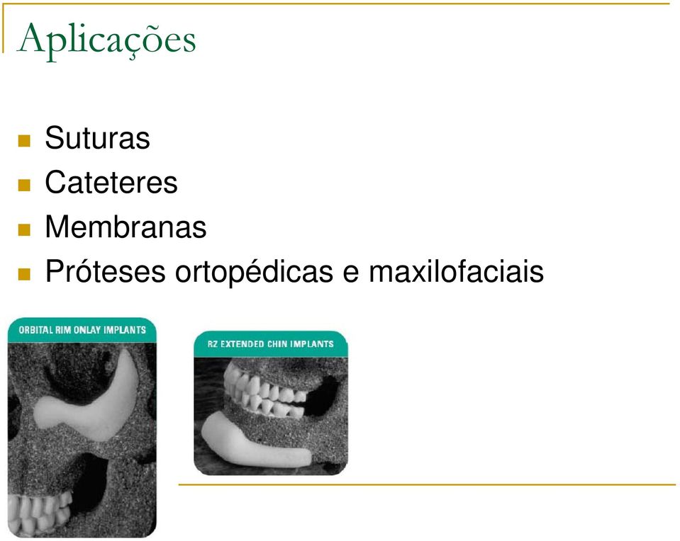 Membranas Próteses