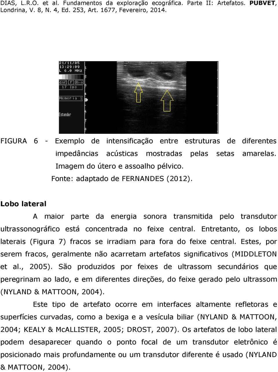 Entretanto, os lobos laterais (Figura 7) fracos se irradiam para fora do feixe central. Estes, por serem fracos, geralmente não acarretam artefatos significativos (MIDDLETON et al., 2005).