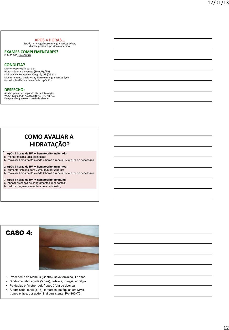 clínica e hematócrito após 12h DESFECHO: Alta hospitalar no segundo dia de internação WBC= 4.200, PLT=78.000, Hto=37,7%, Alb=3,5 Dengue não- grave com sinais de alarme COMO AVALIAR A HIDRATAÇÃO? 1. Após 4 horas de HV à hematócrito inalterado: a) manter mesma taxa de infusão; b) reavaliar hematócrito a cada 4 horas e repetir HV até 3x, se necessário.